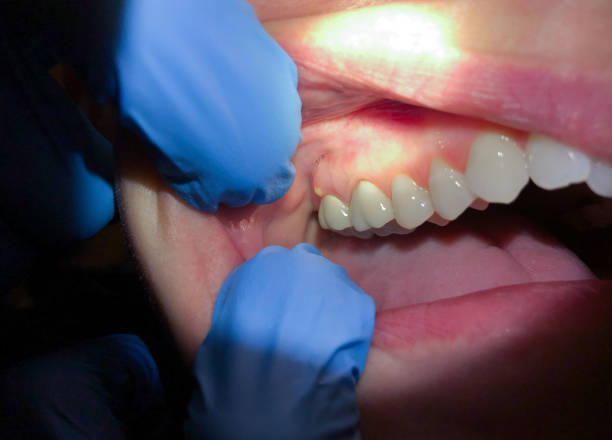 Best Cosmetic Emergency Dentistry in Addison, WV