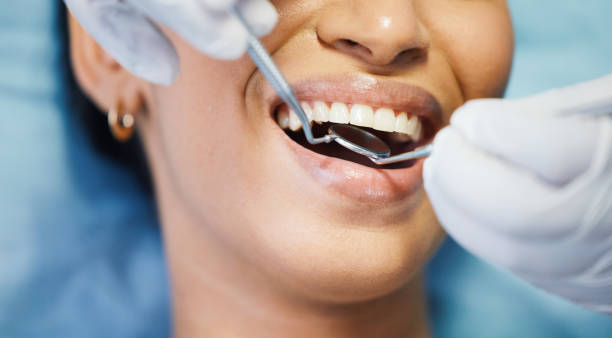 Best Emergency Dental Care for Broken or Chipped Teeth in Addison, WV